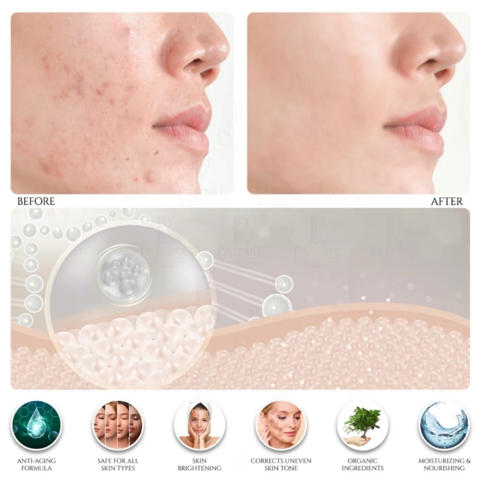 🚨SALE🚨Anti-Aging Hydration & Renewal Set – 6 Pc Skincare Collection (New) - Picture 3 of 11